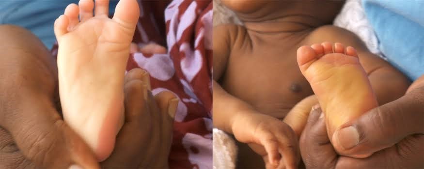 Danger signs in Newborn